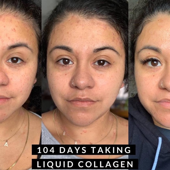 Daily•YOU collagène - 1 month 🍑 - Picture 7 of 7